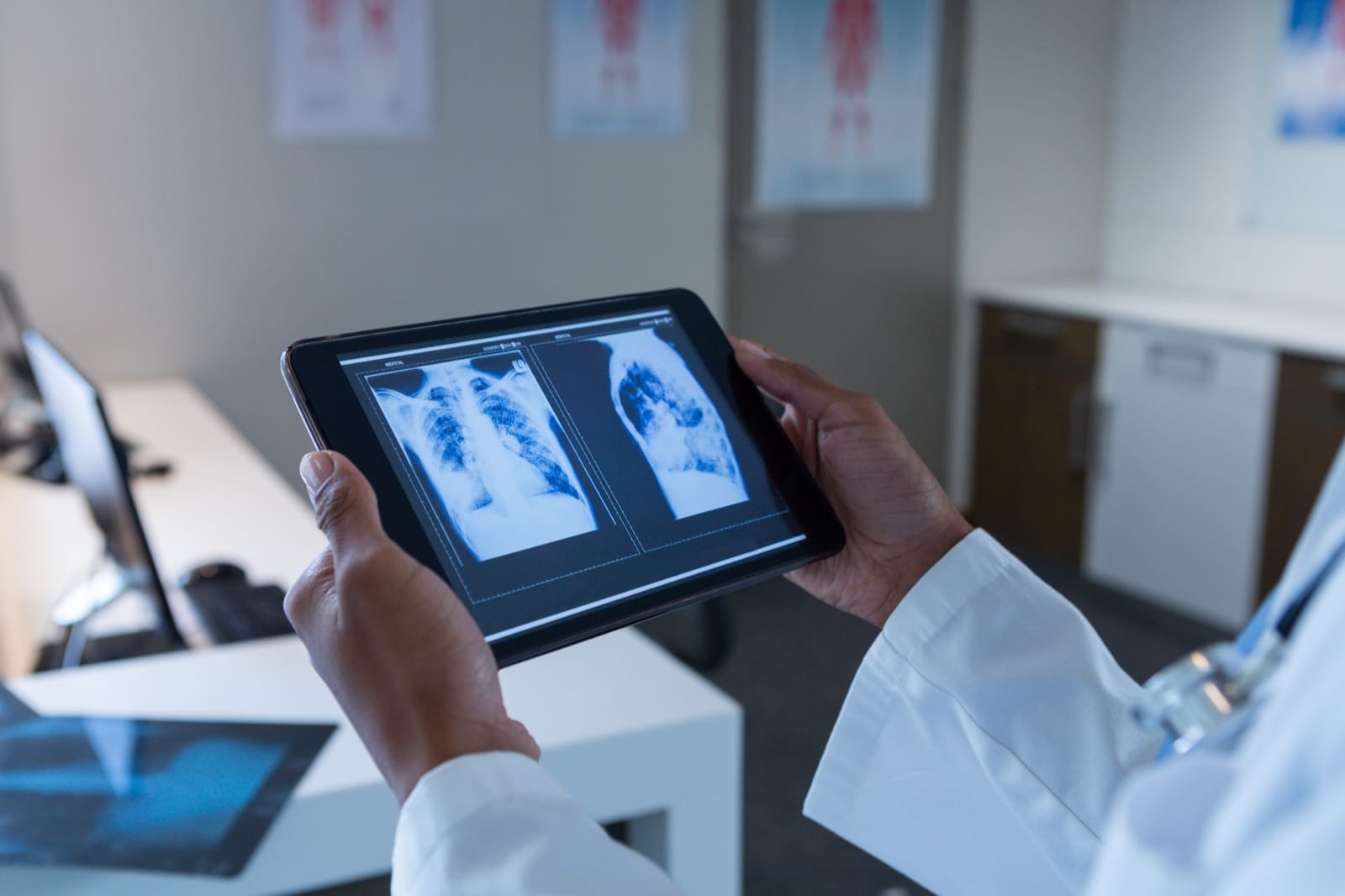 A clinician reviewing medical scans on a tablet